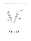 Temporary Retention Device diagram and image