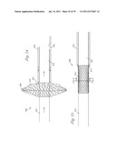 Temporary Retention Device diagram and image