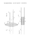 Temporary Retention Device diagram and image