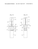 Temporary Retention Device diagram and image