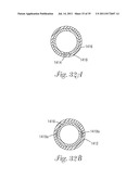 Temporary Retention Device diagram and image