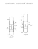 Temporary Retention Device diagram and image