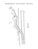 Temporary Retention Device diagram and image