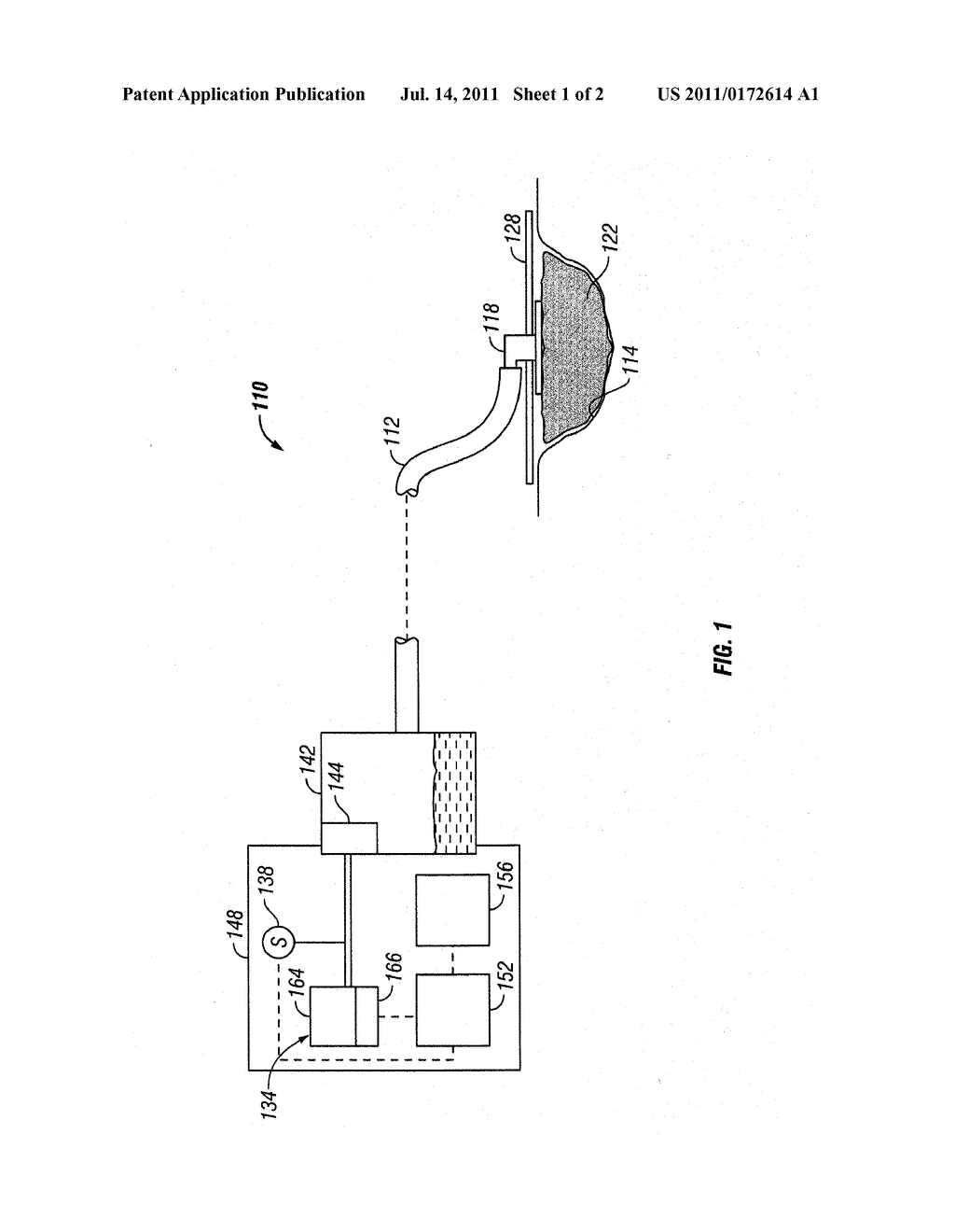 SYSTEM AND METHOD FOR DISTINGUISHING LEAKS FROM A DISENGAGED CANISTER     CONDITION IN A REDUCED PRESSURE TREATMENT SYSTEM - diagram, schematic, and image 02