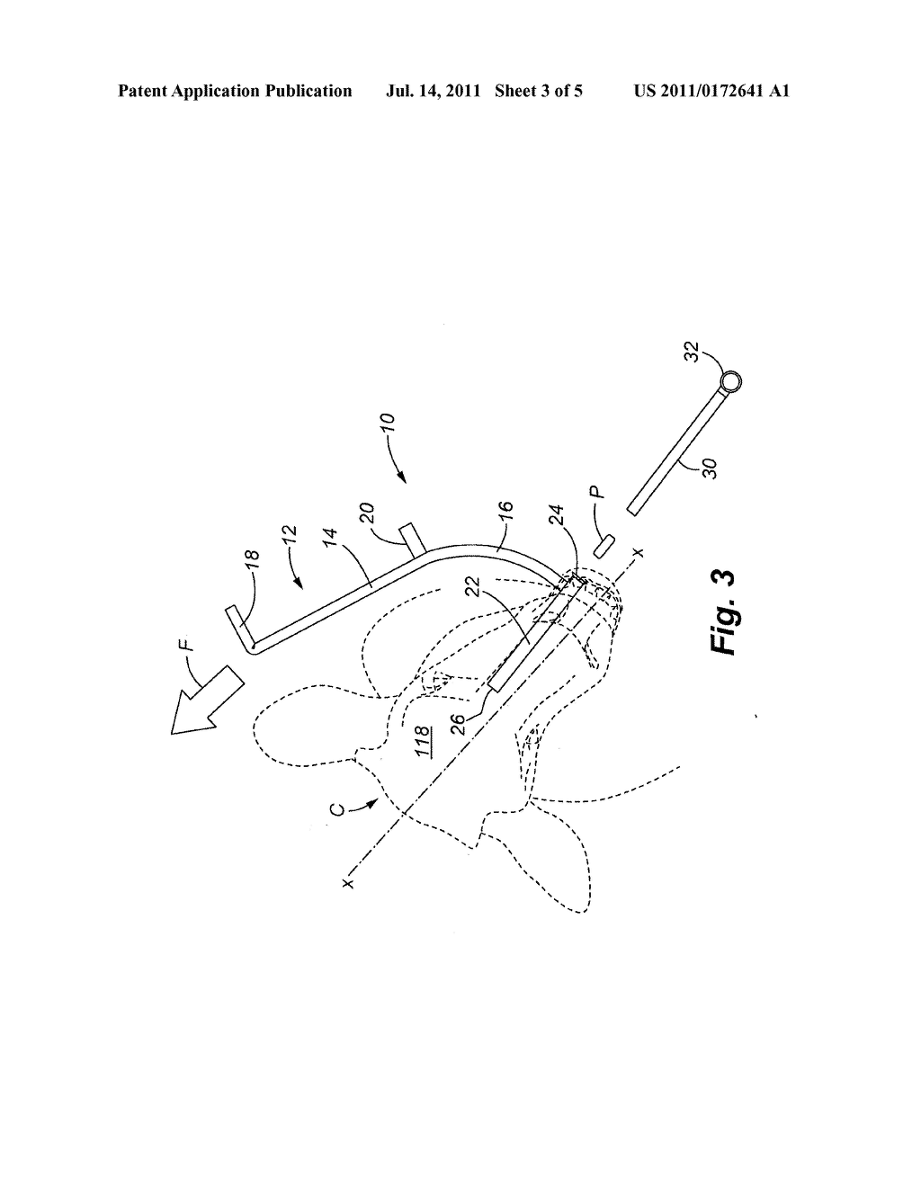 ANIMAL RESTRAINT DEVICE AND METHOD - diagram, schematic, and image 04