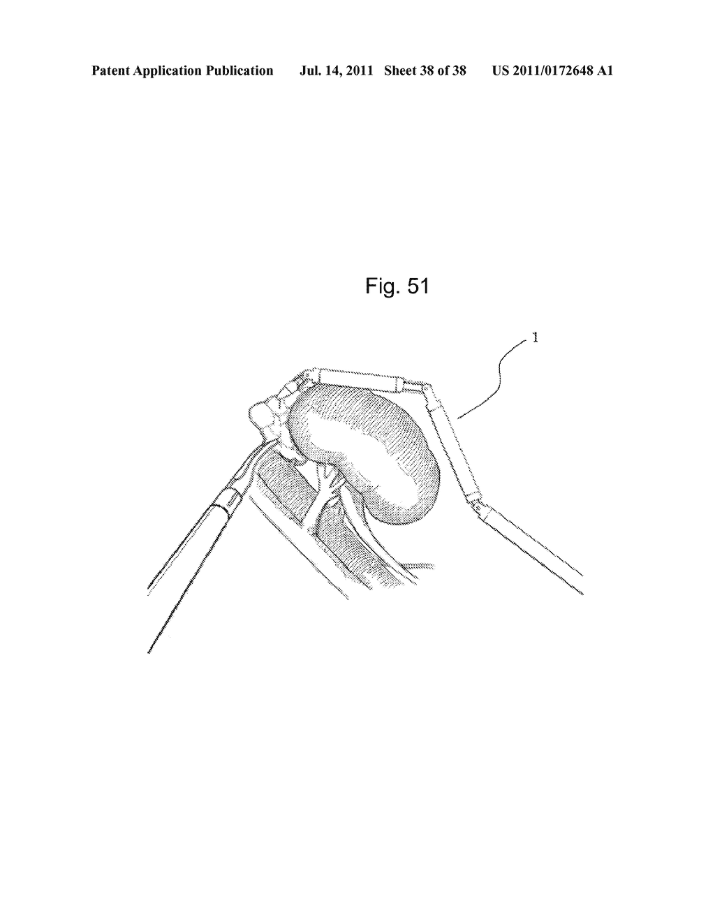 TOOL FOR MINIMALLY INVASIVE SURGERY AND METHOD FOR USING THE SAME - diagram, schematic, and image 39