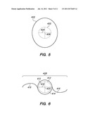 METHOD AND SYSTEM FOR MODIFYING EYE TISSUE AND INTRAOCULAR LENSES diagram and image