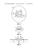 METHOD AND SYSTEM FOR MODIFYING EYE TISSUE AND INTRAOCULAR LENSES diagram and image