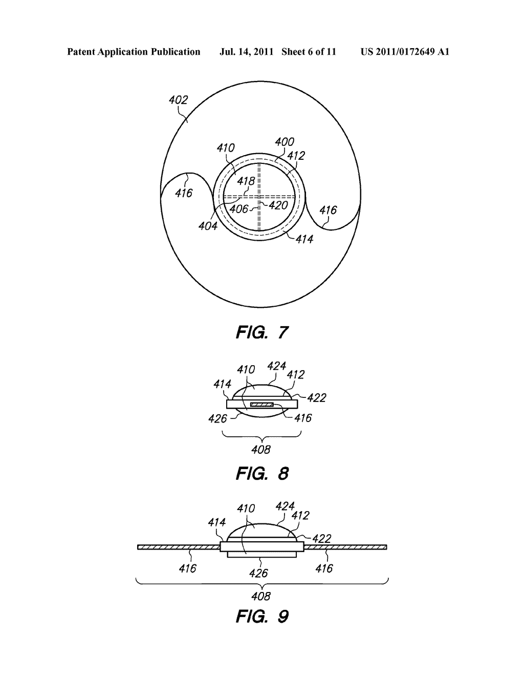 METHOD AND SYSTEM FOR MODIFYING EYE TISSUE AND INTRAOCULAR LENSES - diagram, schematic, and image 07