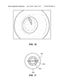 METHOD AND SYSTEM FOR MODIFYING EYE TISSUE AND INTRAOCULAR LENSES diagram and image