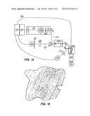 METHOD AND SYSTEM FOR MODIFYING EYE TISSUE AND INTRAOCULAR LENSES diagram and image