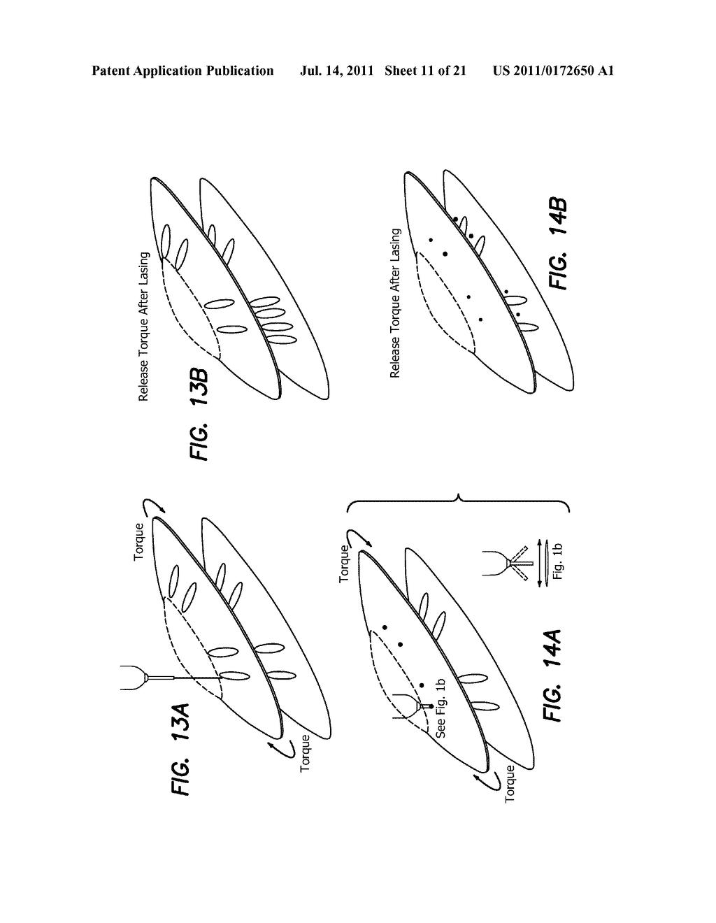 METHODS FOR TREATING EYE CONDITIONS - diagram, schematic, and image 12