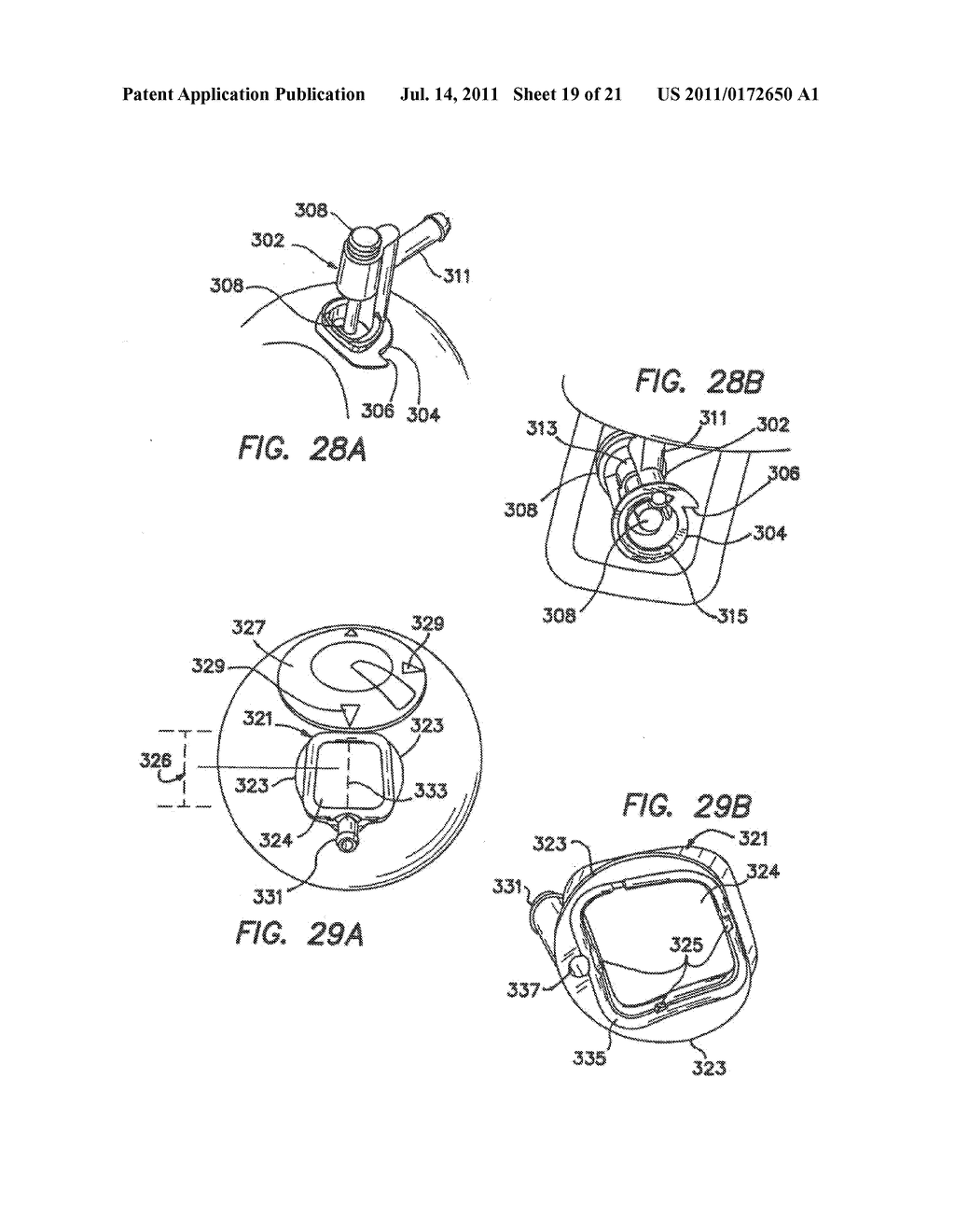 METHODS FOR TREATING EYE CONDITIONS - diagram, schematic, and image 20