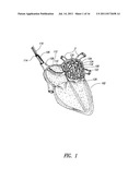 MEDICAL DEVICE FOR USE IN BODILY LUMENS, FOR EXAMPLE AN ATRIUM diagram and image