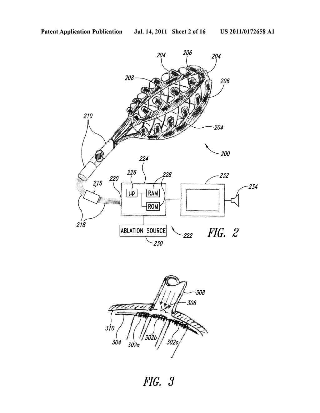 MEDICAL DEVICE FOR USE IN BODILY LUMENS, FOR EXAMPLE AN ATRIUM - diagram, schematic, and image 03