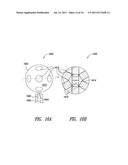 MEDICAL DEVICE FOR USE IN BODILY LUMENS, FOR EXAMPLE AN ATRIUM diagram and image