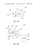 MEDICAL DEVICE FOR USE IN BODILY LUMENS, FOR EXAMPLE AN ATRIUM diagram and image