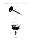 Orthopedic/Spine Bone Mill diagram and image