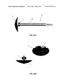 Orthopedic/Spine Bone Mill diagram and image