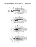 IMPLANT EXTRACTION TOOL diagram and image