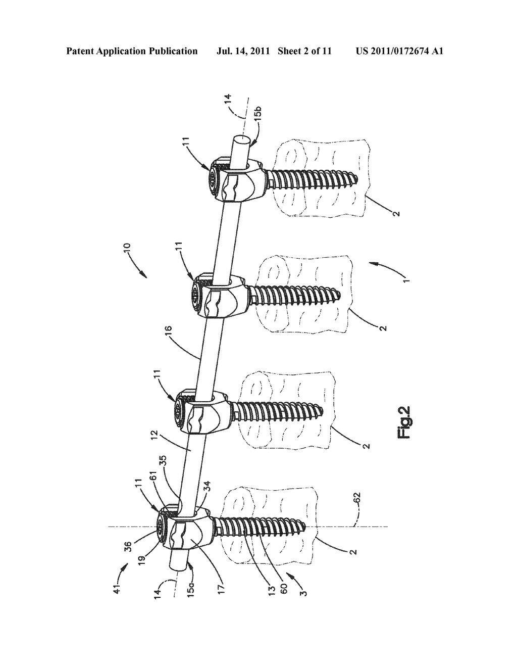 System and Methods for Minimally Invasive Spine Surgery - diagram, schematic, and image 03