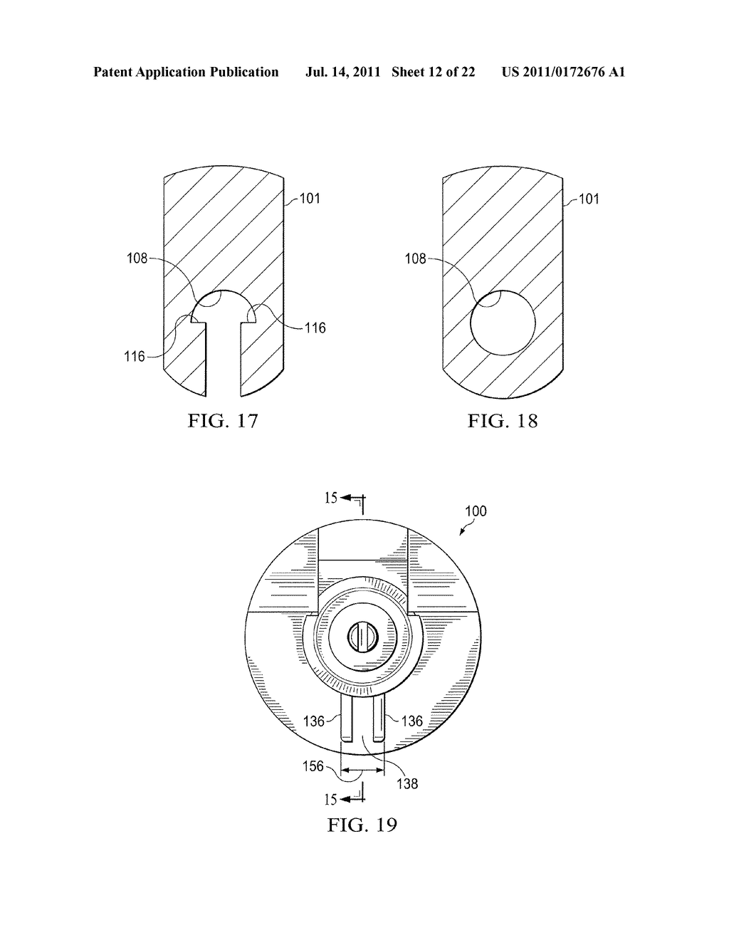 PLUNGER TIP COUPLING DEVICE FOR INTRAOCULAR LENS INJECTOR - diagram, schematic, and image 13