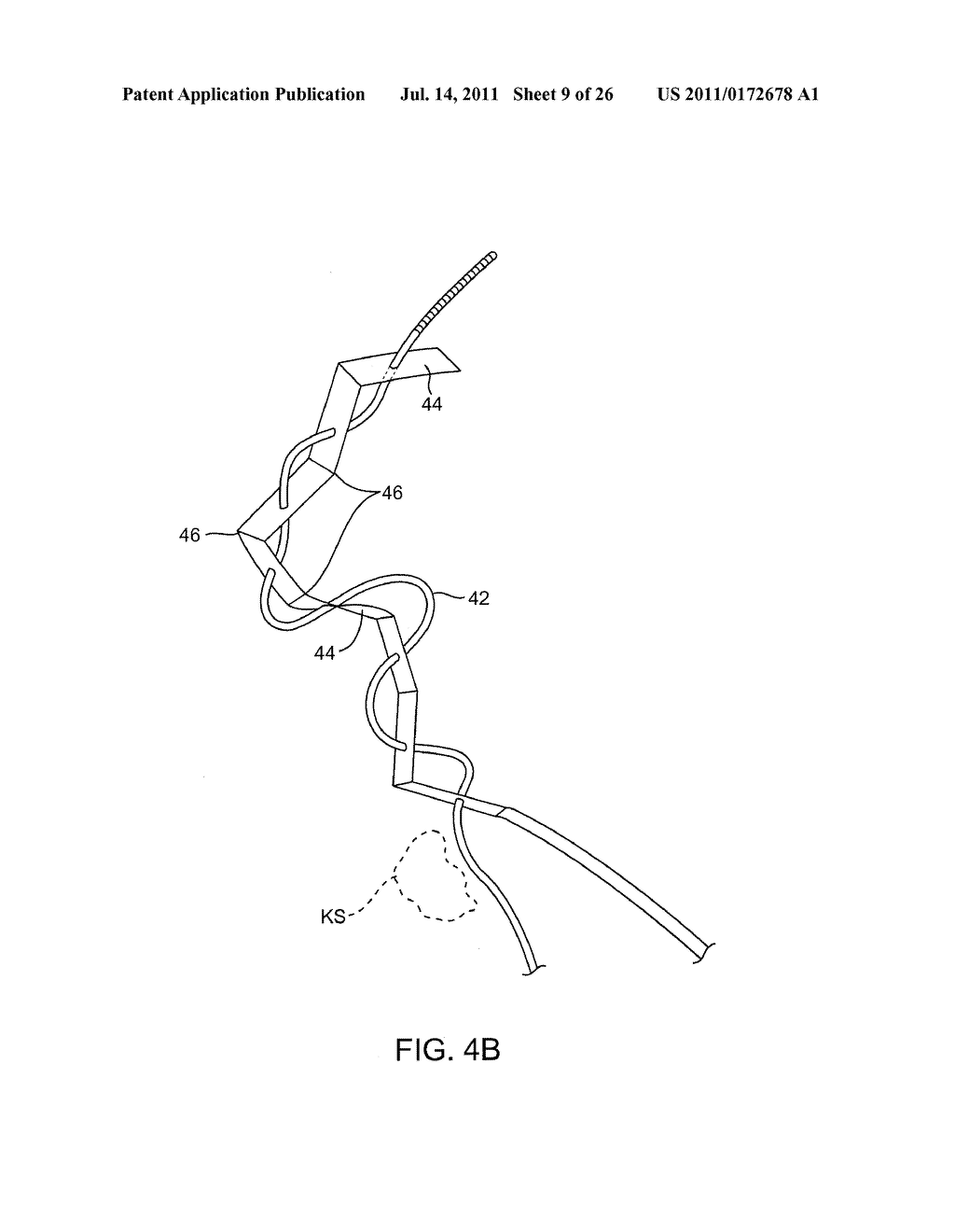 METHODS AND APPARATUS FOR DEPLOYING URETERAL STENTS - diagram, schematic, and image 10