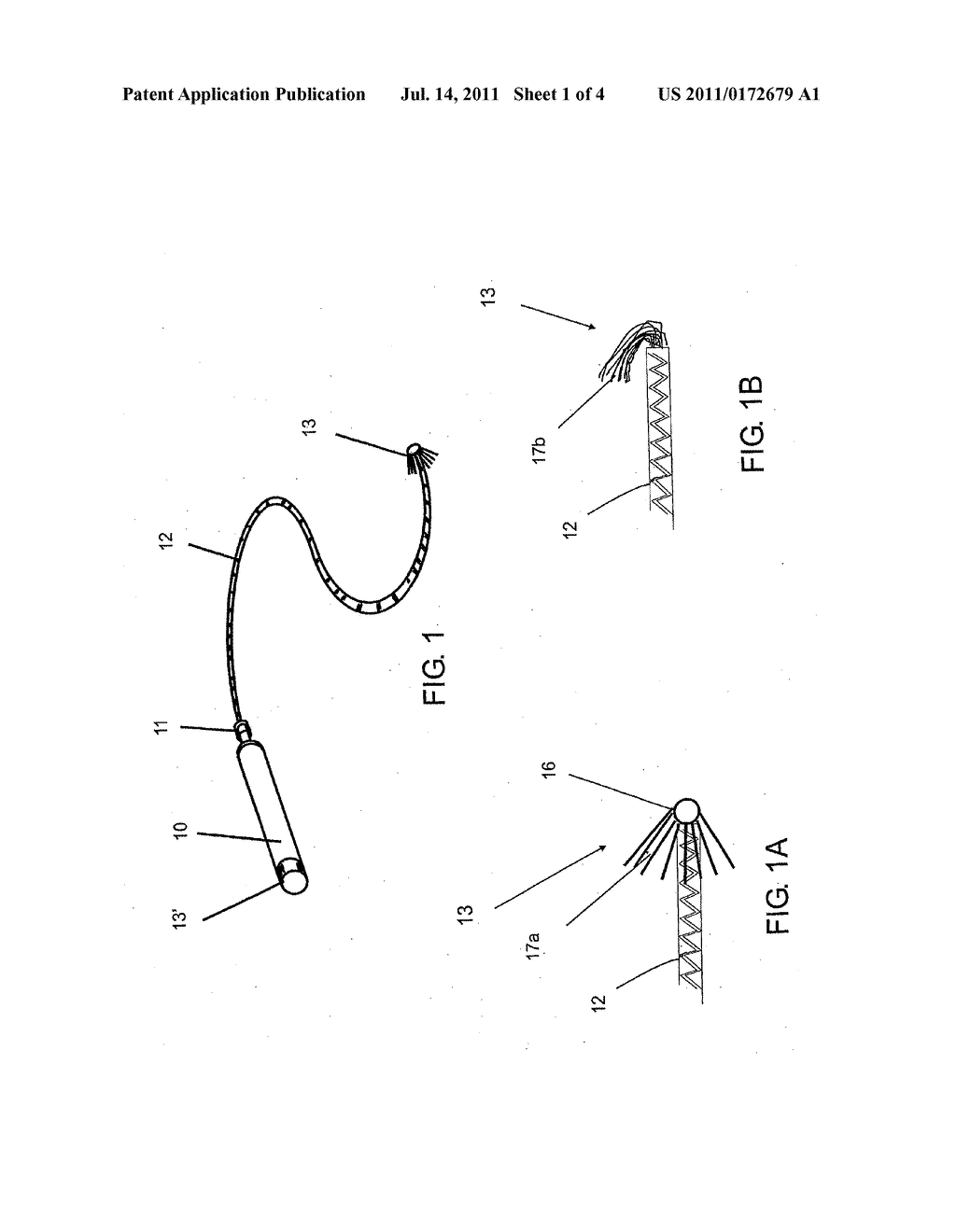 METHOD OF IMPLANTING MICRODEVICE WITH EXTENDED LEAD AND REMOTE ELECTRODE - diagram, schematic, and image 02