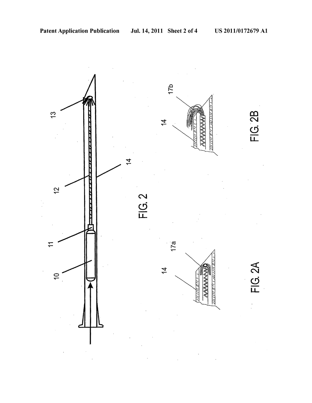 METHOD OF IMPLANTING MICRODEVICE WITH EXTENDED LEAD AND REMOTE ELECTRODE - diagram, schematic, and image 03