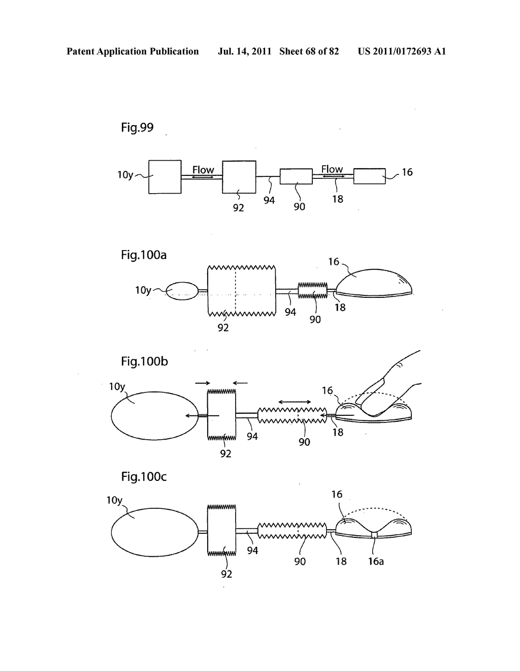 APPARATUS AND METHOD FOR TREATING OBESITY - diagram, schematic, and image 69