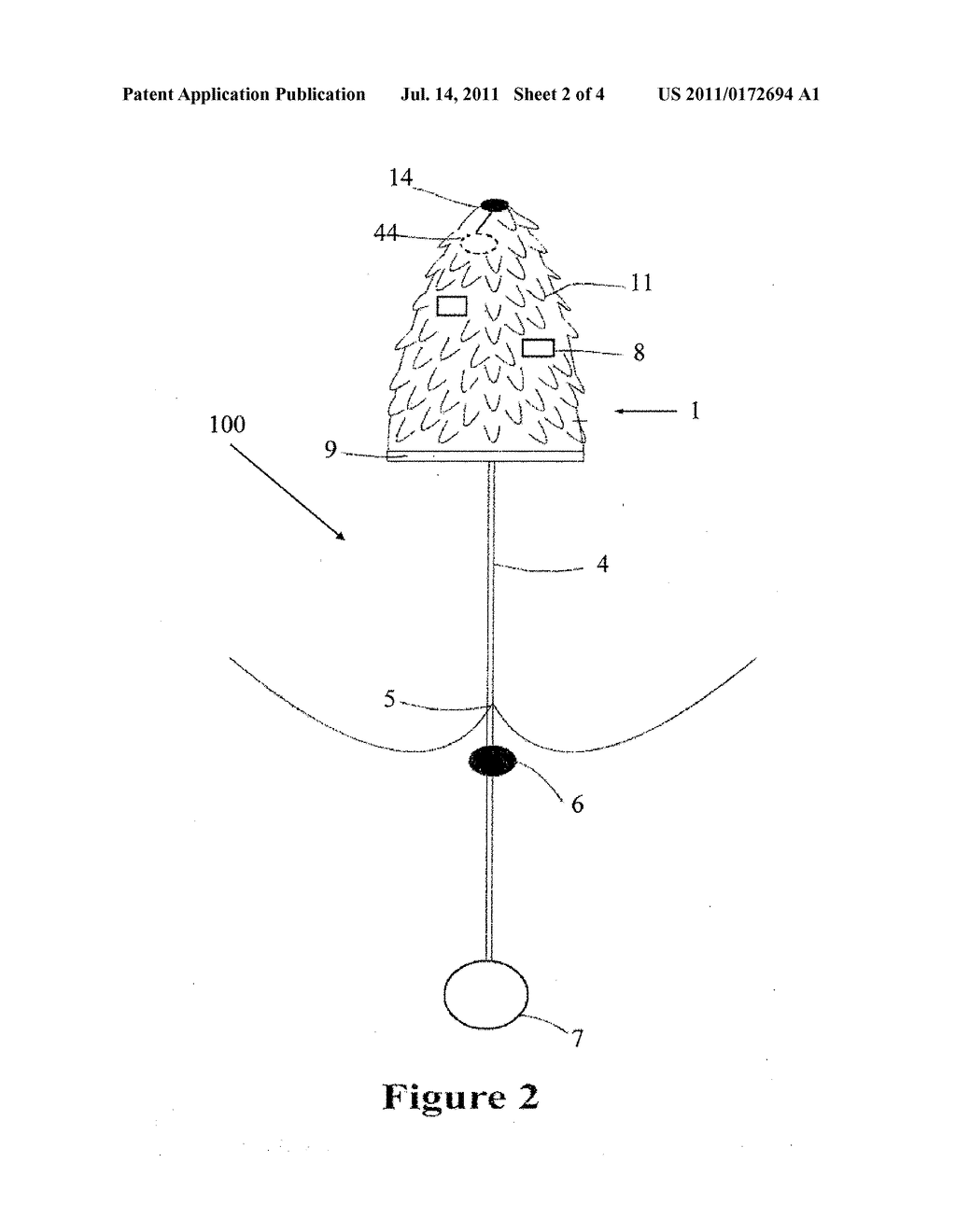 DEVICE AND METHOD FOR CONTROLLING FECAL INCONTINENCE - diagram, schematic, and image 03