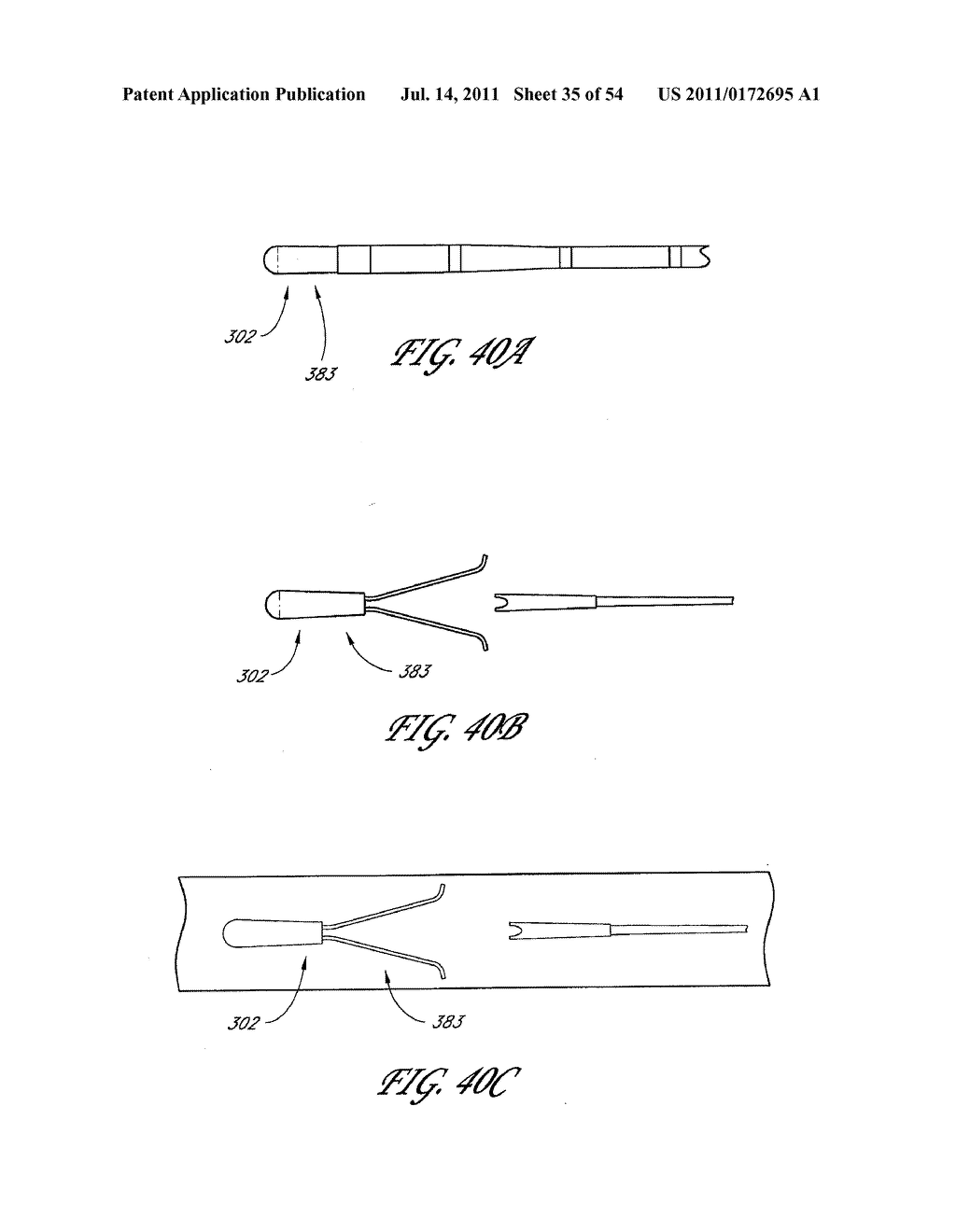 METHOD AND APPARATUS FOR IMPLANTING AN OCCLUSIVE STRUCTURE - diagram, schematic, and image 36