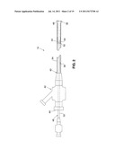 SYSTEM AND METHOD FOR TREATING ISCHEMIC STROKE diagram and image