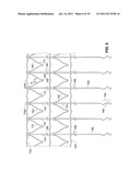 SYSTEM AND METHOD FOR TREATING ISCHEMIC STROKE diagram and image