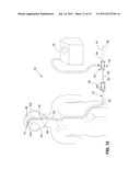 SYSTEM AND METHOD FOR TREATING ISCHEMIC STROKE diagram and image