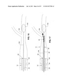 SYSTEM AND METHOD FOR TREATING ISCHEMIC STROKE diagram and image