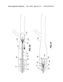 SYSTEM AND METHOD FOR TREATING ISCHEMIC STROKE diagram and image