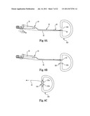 INTERVERTEBRAL DISC ANNULUS REPAIR SYSTEM AND METHOD diagram and image