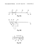 INTERVERTEBRAL DISC ANNULUS REPAIR SYSTEM AND METHOD diagram and image