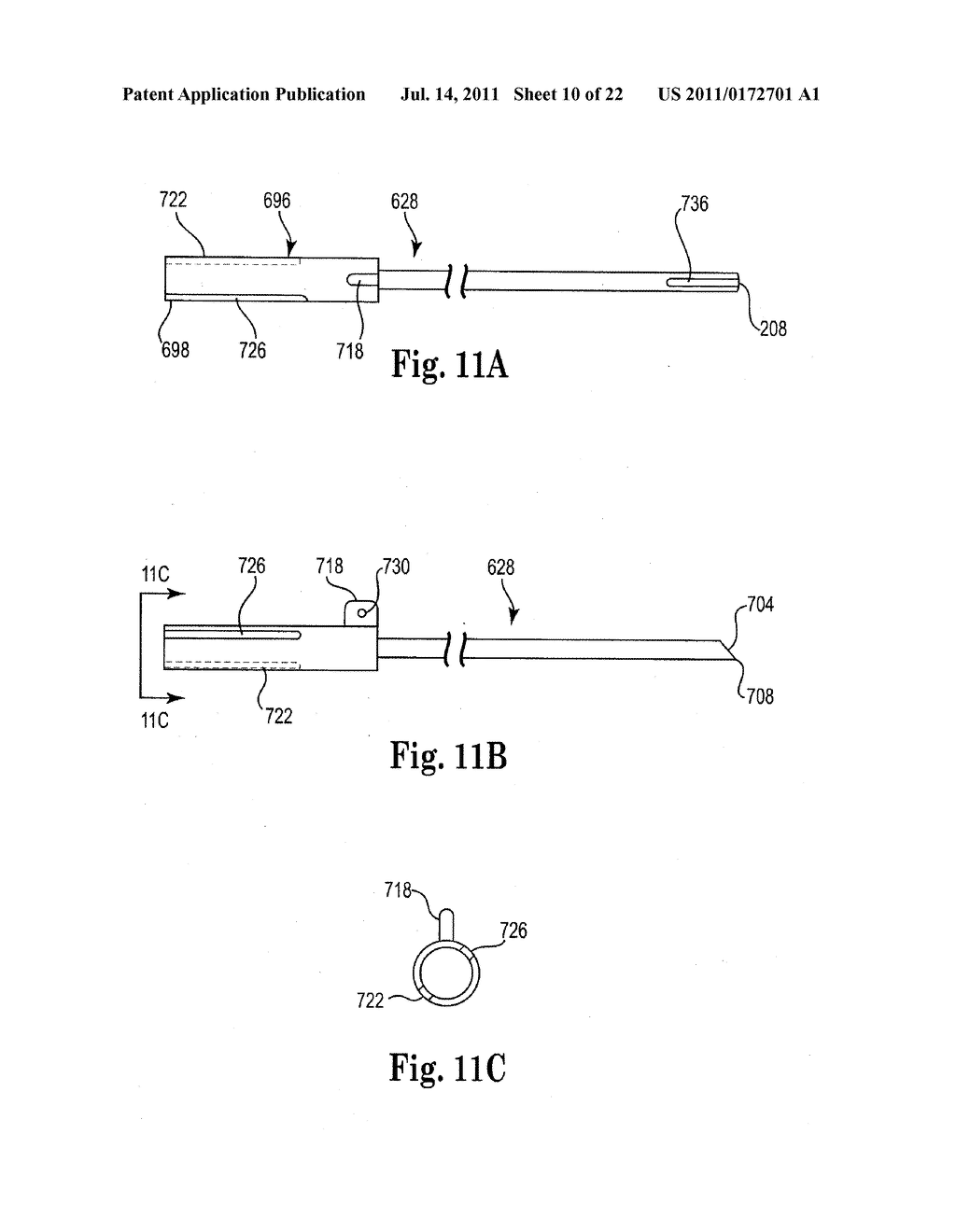 INTERVERTEBRAL DISC ANNULUS REPAIR SYSTEM AND METHOD - diagram, schematic, and image 11