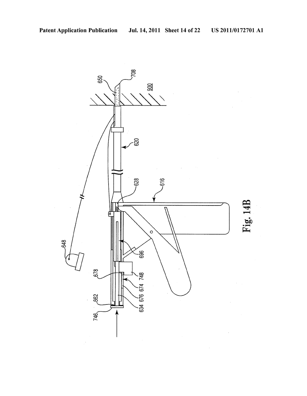 INTERVERTEBRAL DISC ANNULUS REPAIR SYSTEM AND METHOD - diagram, schematic, and image 15