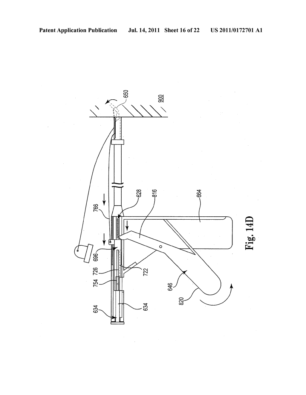 INTERVERTEBRAL DISC ANNULUS REPAIR SYSTEM AND METHOD - diagram, schematic, and image 17