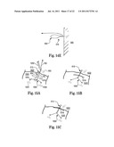 INTERVERTEBRAL DISC ANNULUS REPAIR SYSTEM AND METHOD diagram and image