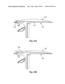 INTERVERTEBRAL DISC ANNULUS REPAIR SYSTEM AND METHOD diagram and image