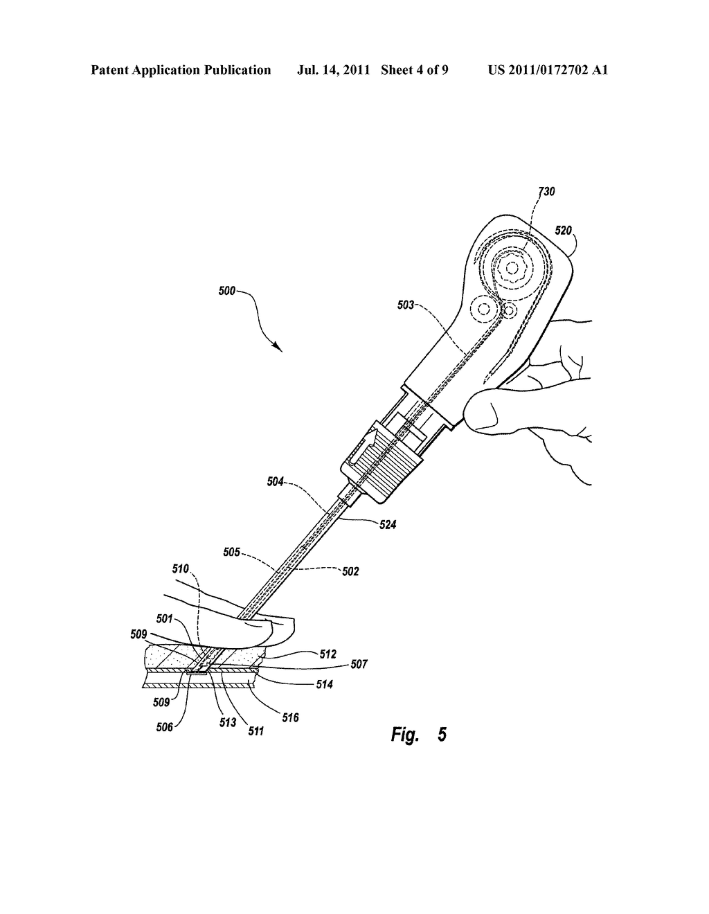 TISSUE PUNCTURE CLOSURE DEVICE WITH AUTOMATIC TAMPING - diagram, schematic, and image 05