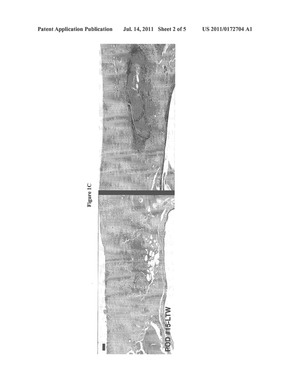 SOLDER FORMULATION AND USE IN TISSUE WELDING - diagram, schematic, and image 03