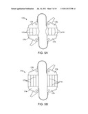 METHODS AND SYSTEMS FOR INCREASING THE BENDING STIFFNESS OF A SPINAL     SEGMENT WITH ELONGATION LIMIT diagram and image