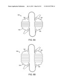 METHODS AND SYSTEMS FOR INCREASING THE BENDING STIFFNESS OF A SPINAL     SEGMENT WITH ELONGATION LIMIT diagram and image