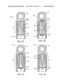 METHODS AND SYSTEMS FOR INCREASING THE BENDING STIFFNESS OF A SPINAL     SEGMENT WITH ELONGATION LIMIT diagram and image