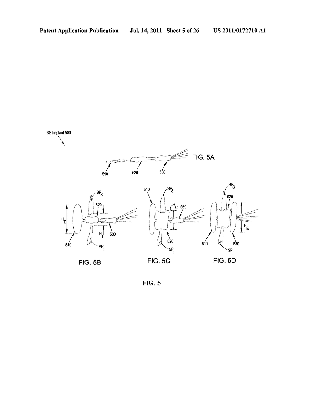 MINIMALLY INVASIVE INTERSPINOUS PROCESS SPACER IMPLANTS AND METHODS - diagram, schematic, and image 06